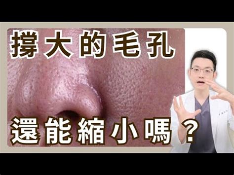 臉上有白毛|臉長白毛位置暗示何事？